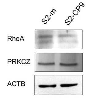 The level of expression of RHOA and PRKCZ in S2-m and S2-CP9 subclones.jpg